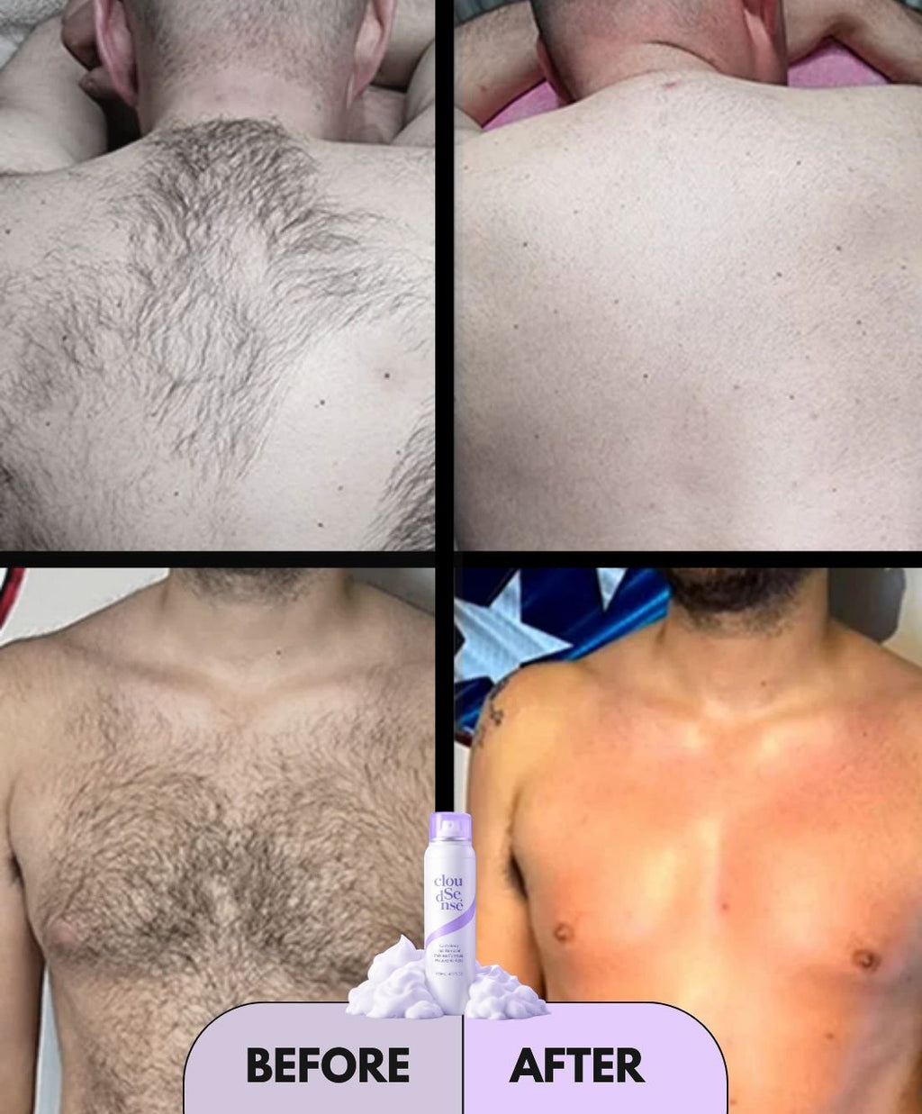 Hair Removal Spray