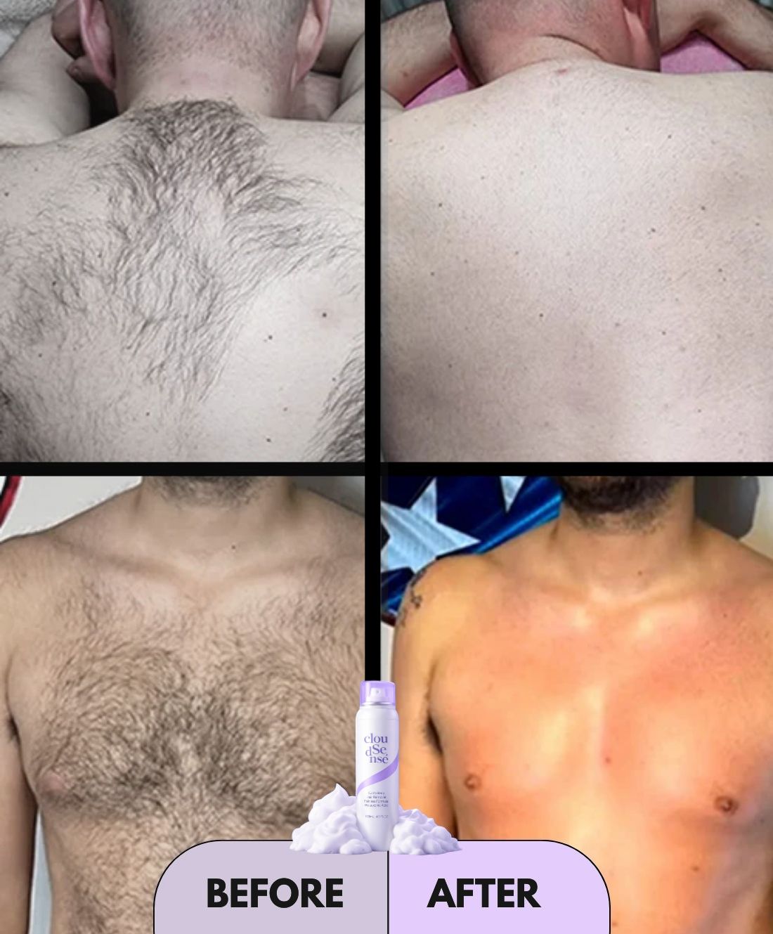 Hair Removal Spray