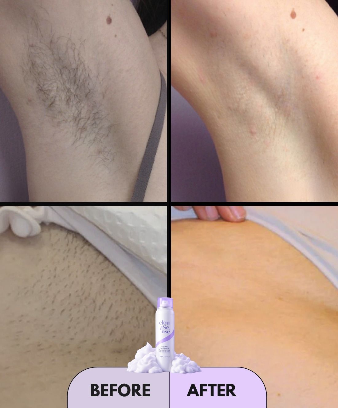 Hair Removal Spray
